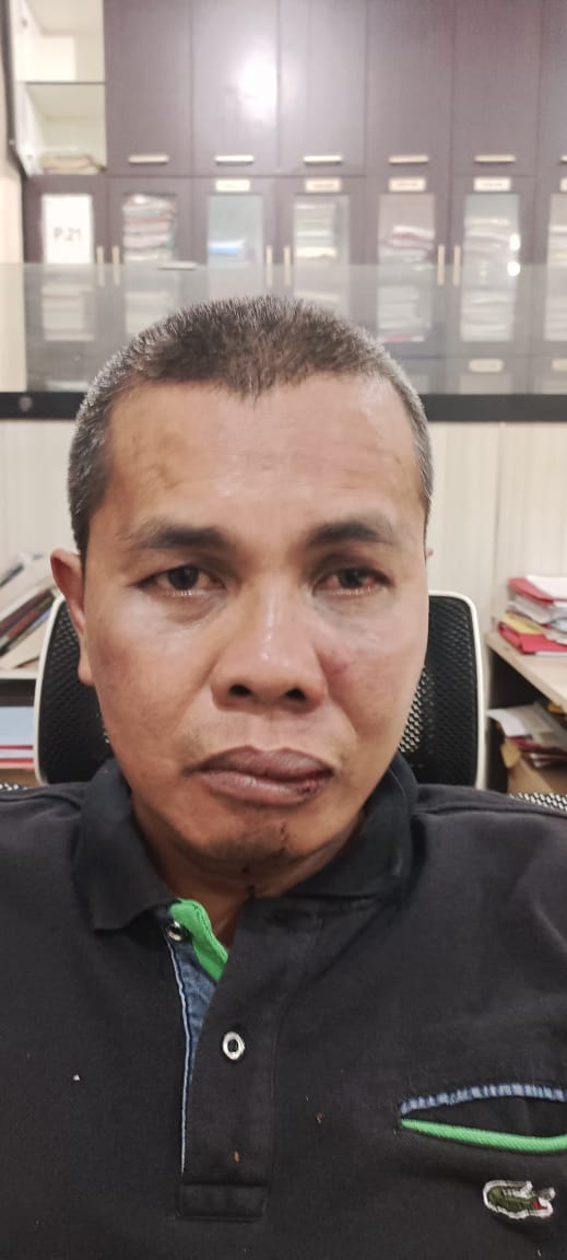 Mengejutkan, Nusarman Korban di Lahan Adat Rajo Deko Mengaku Dipukul, Ditendang Bahkan Diinjak